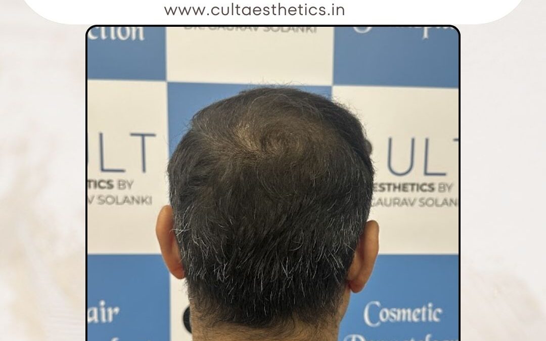 Hair Case 393 After 4