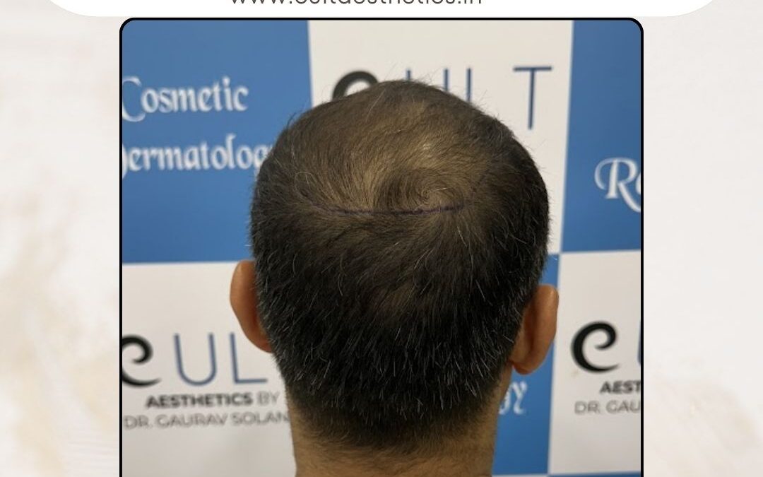 Hair Case 393 Before 4