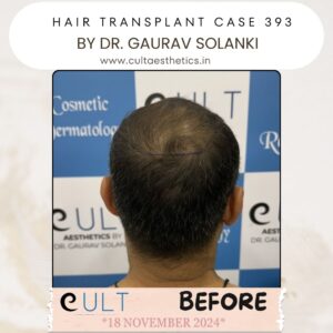 hair case 393 Before-4