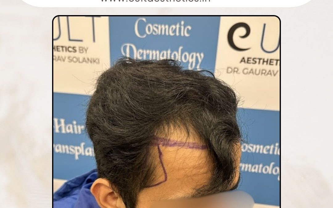 Hair Case 394 Before 2