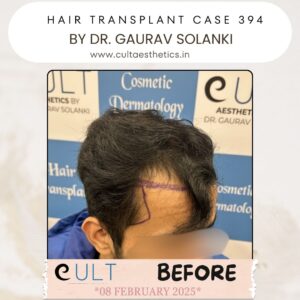 hair case 394 Before-2