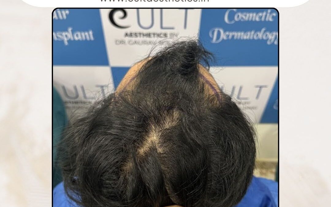 Hair Case 394 Before 4