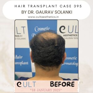 hair case 395 Before-4