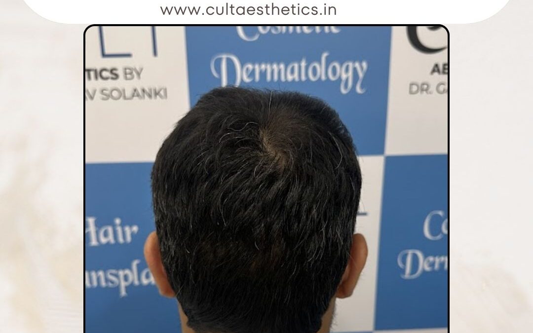 Hair Case 396 After 4