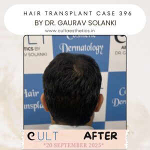 hair case 396 After-3