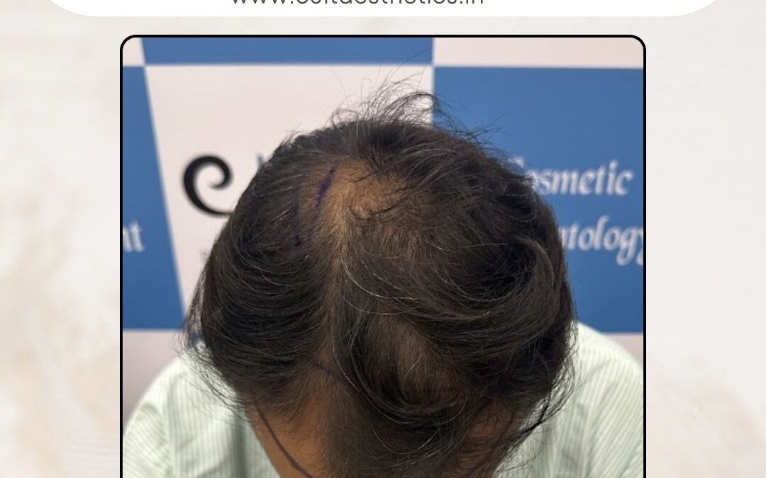 Hair Case 396 Before 2