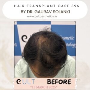 hair case 396 Before-2