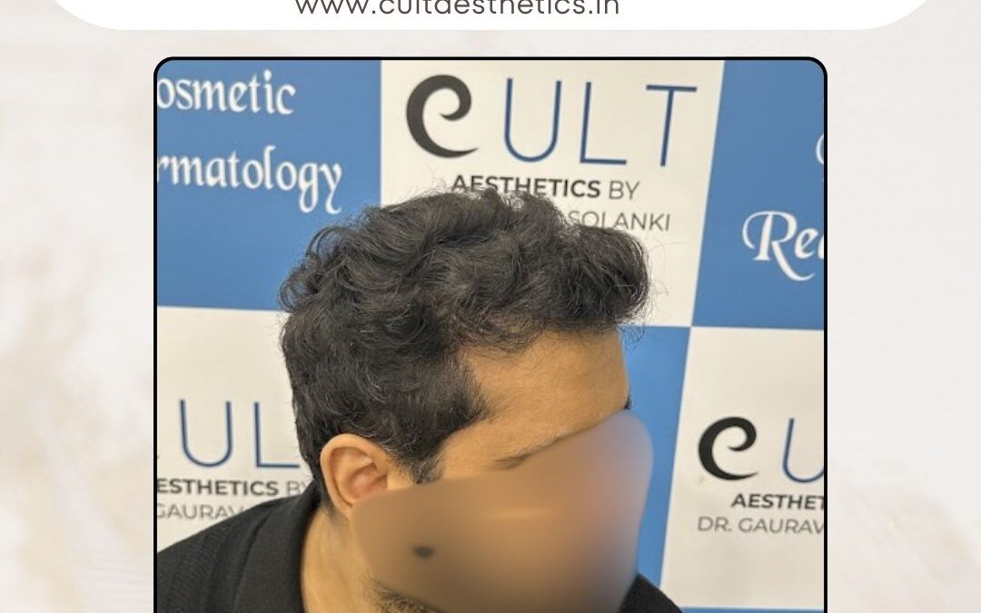 Hair Case 397 After 2
