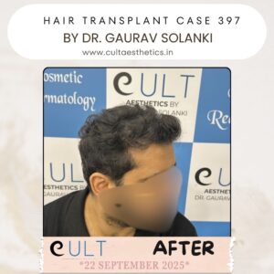 hair case 397 After-2