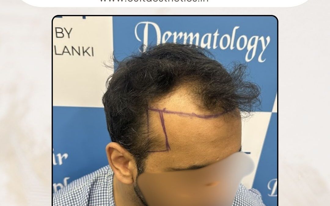 Hair Case 397 Before 2