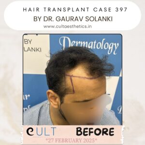 hair case 397 Before-2