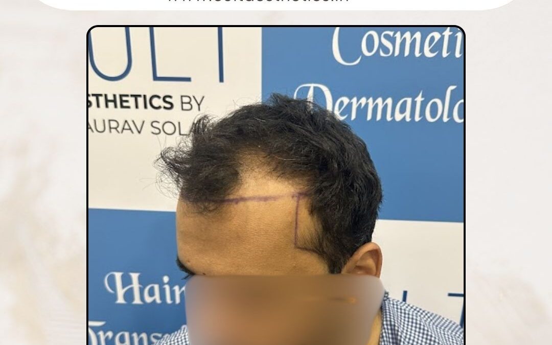 Hair Case 397 Before 3