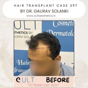 hair case 397 Before-3