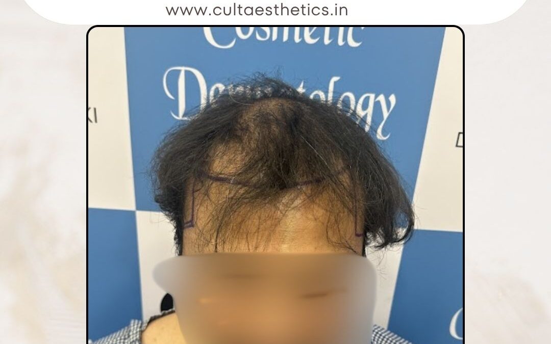 Hair Case 398 Before 1