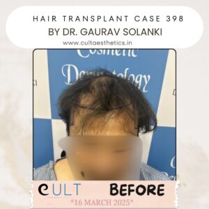 Hair case 398 Before-1