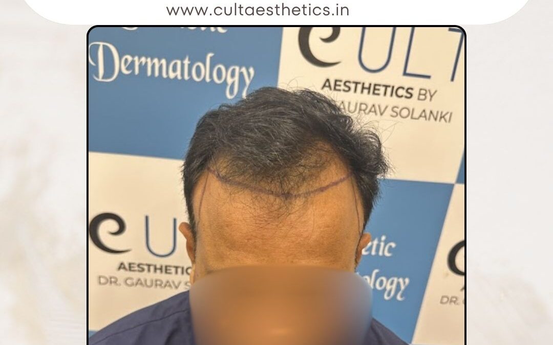 Hair Case 401 Before 1