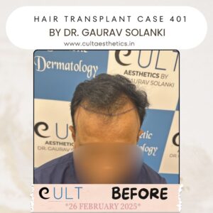 Hair case 401 Before-1