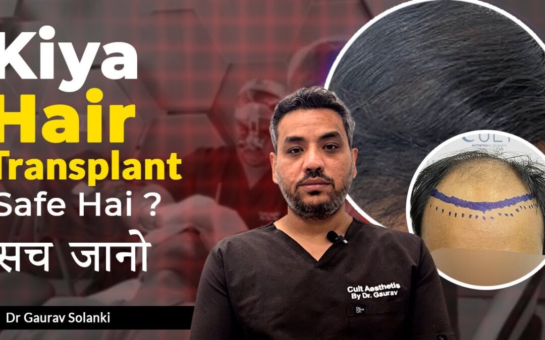 How Safe Is Hair Transplant? Debunking Myths and Sharing Facts