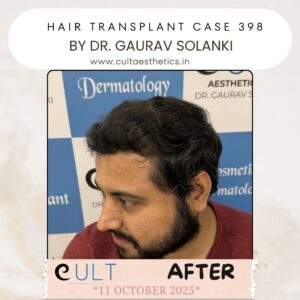 hair case 398 After-3