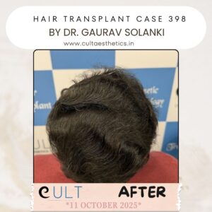 hair case 398 After-4