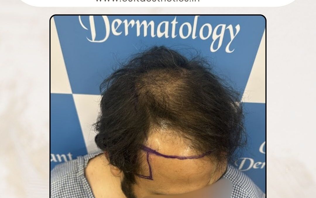 Hair Case 398 Before 2