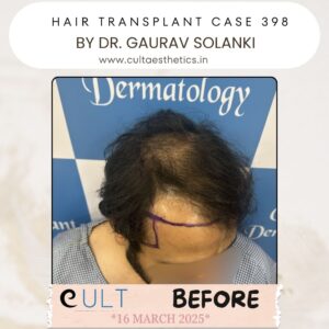 hair case 398 Before-2