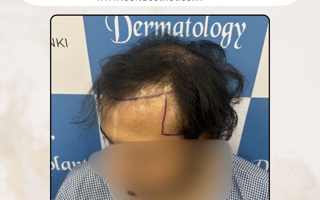 Hair Case 398 Before 3