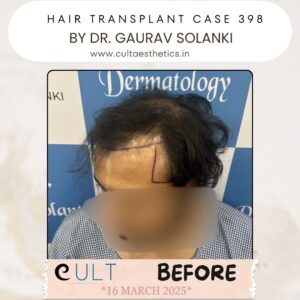 hair case 398 Before-3