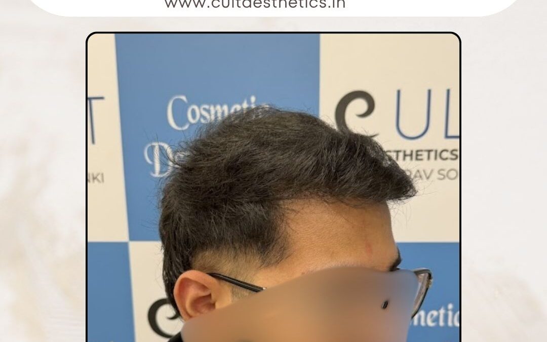 Hair Case 399 After 2