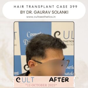 hair case 399 After-2