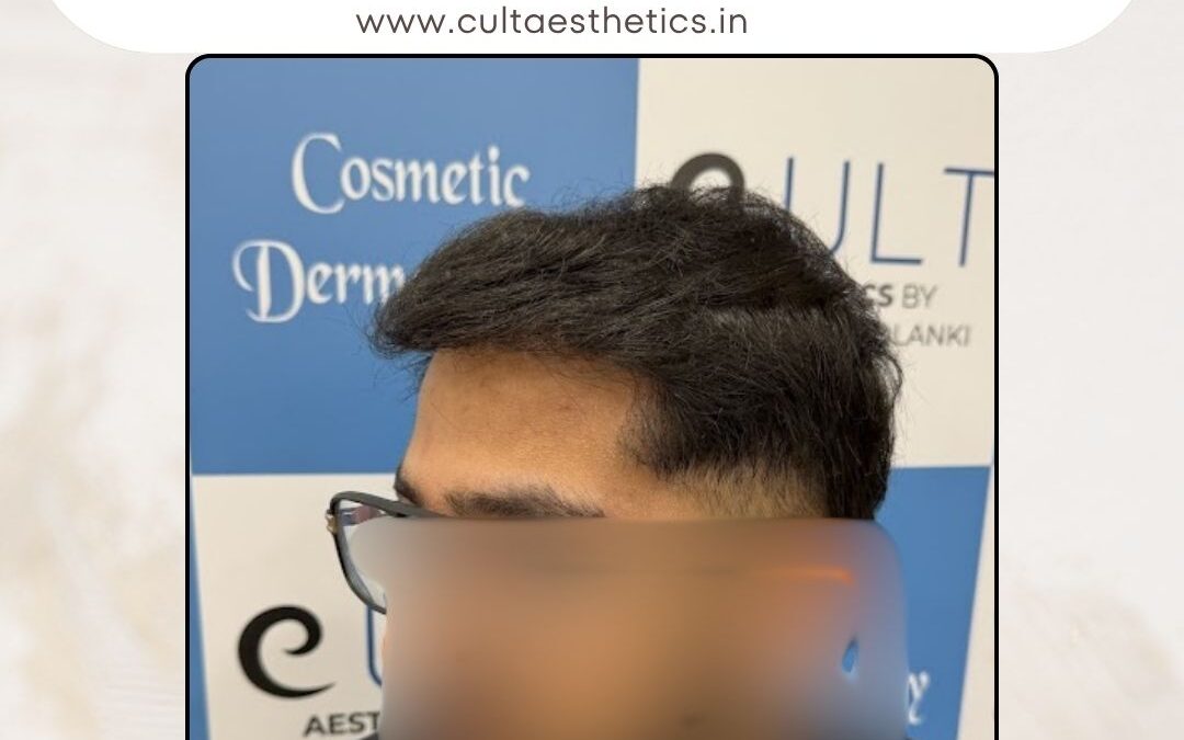 Hair Case 399 After 3