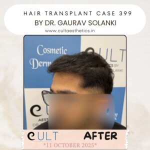 hair case 399 After-3