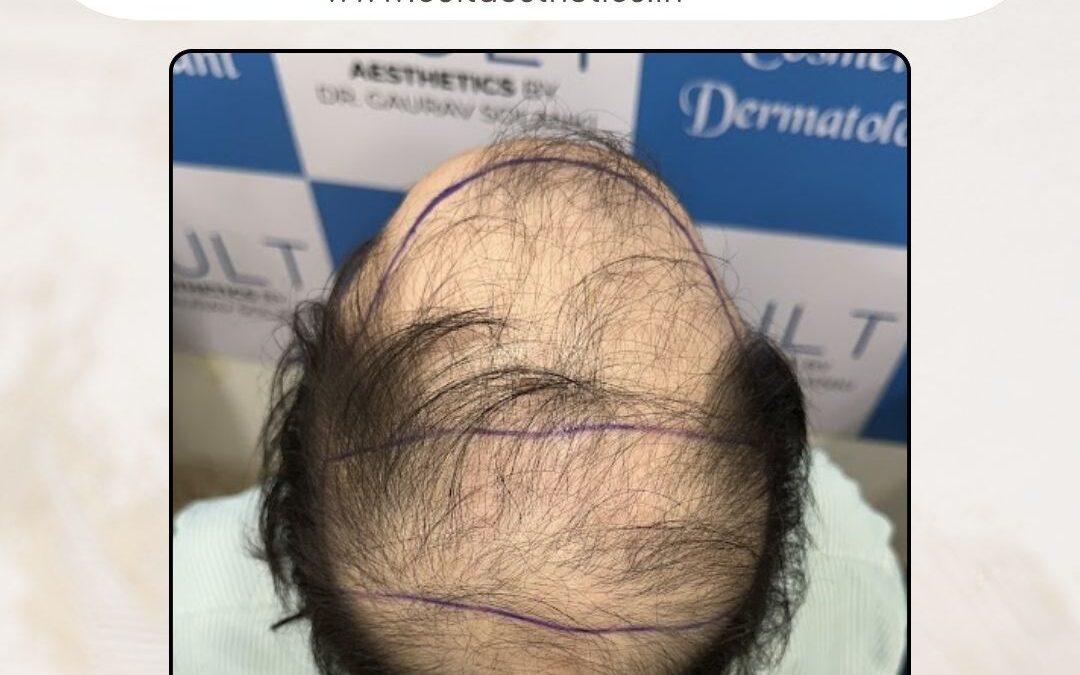 Hair Case 400 Before 3