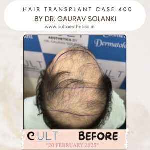 hair case 400 Before-3