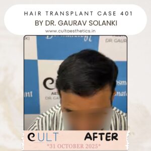 hair case 401 After-3