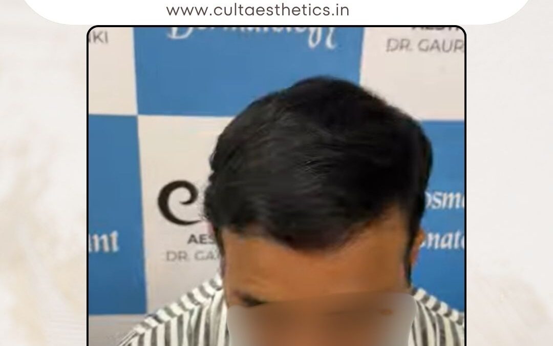Hair Case 401 After 3