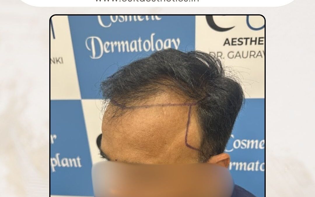 Hair Case 401 Before 2