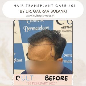 hair case 401 Before-2