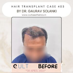 Hair case 403 Before-1