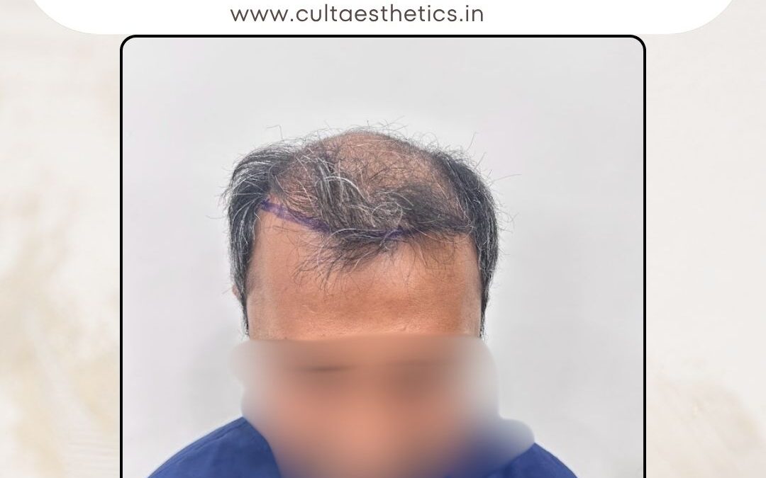 Hair Case 403 Before 1