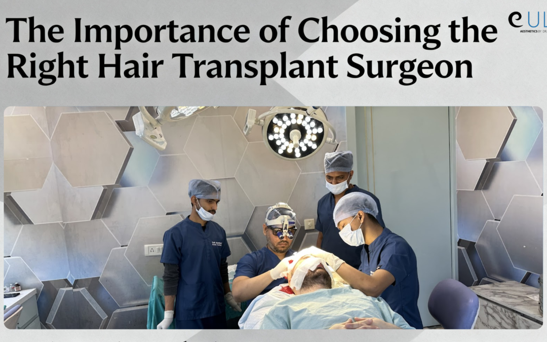 The Importance of Choosing the Right Hair Transplant Surgeon