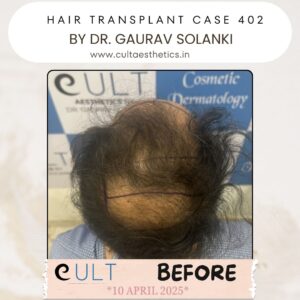 hair case 402 Before-2