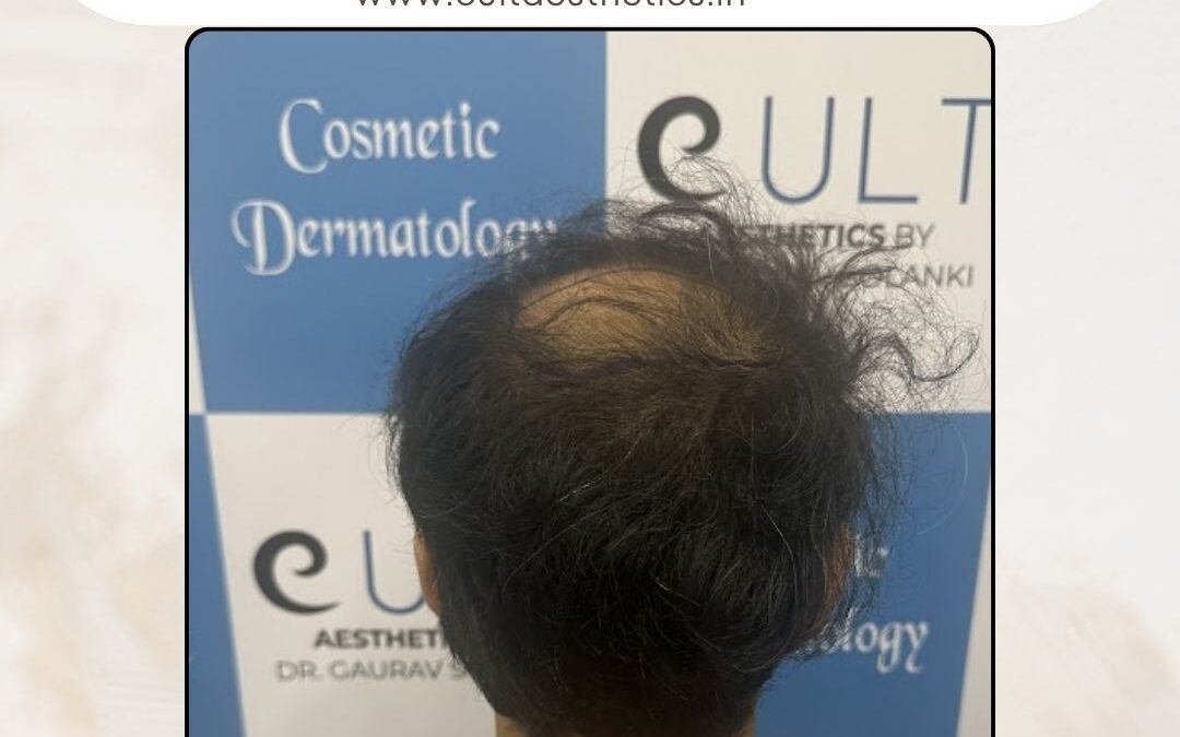 Hair Case 402 Before 4