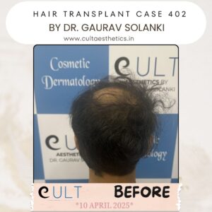 hair case 402 Before-4