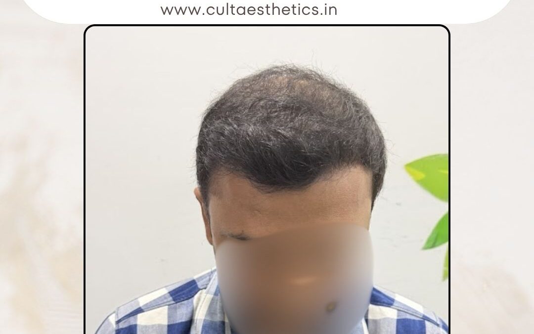 Hair Case 403 After 4