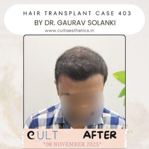 hair case 403 After-4