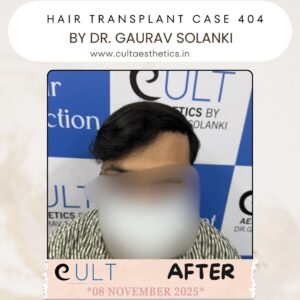hair case 404 After-1