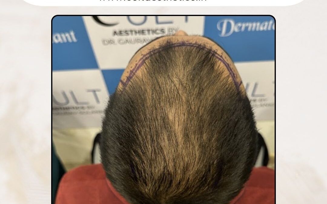 Hair Case 404 Before 3