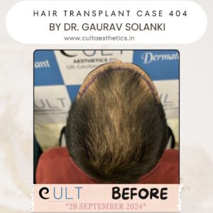 hair case 404 Before-3