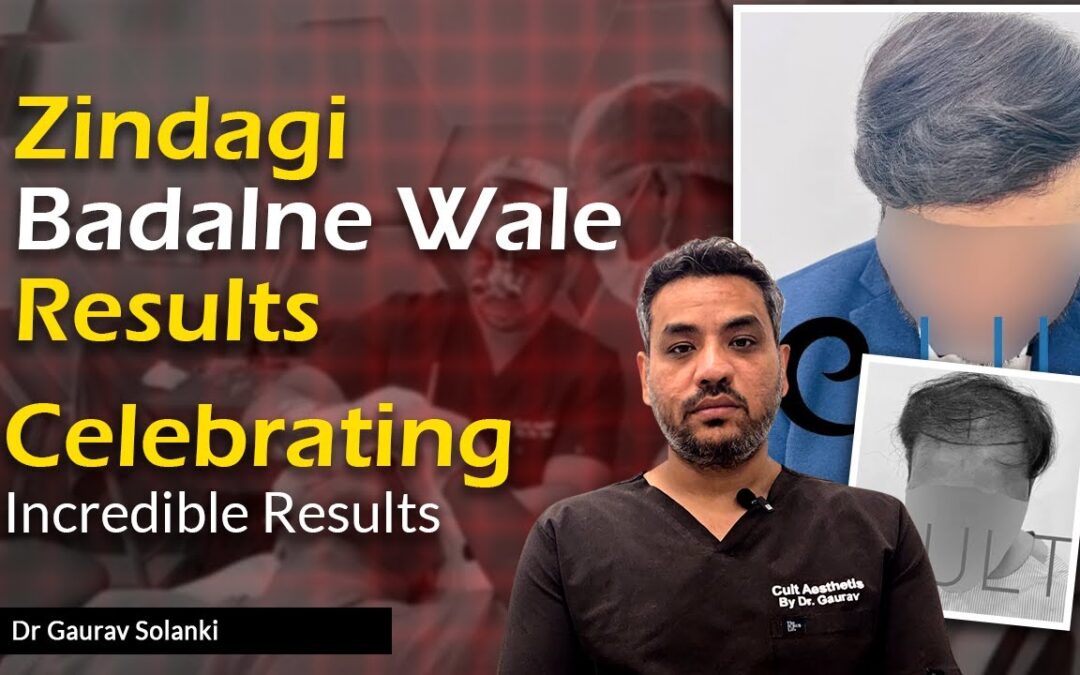 Natural Hair Transplant Results | Celebrating Success & Trust